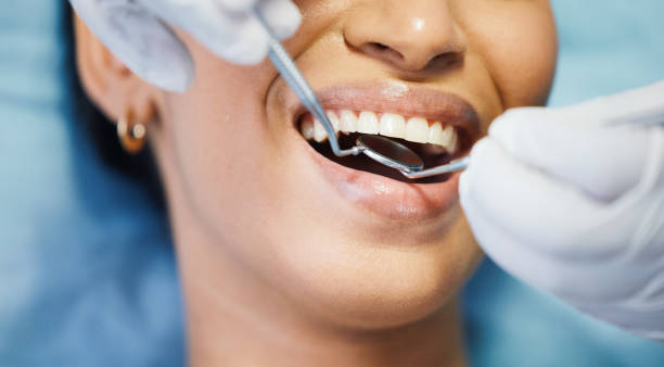 Best Emergency Dental Care for Sports Injuries in Pinardville, NH